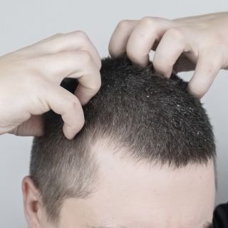 Migliora la Salute del Cuoio Capelluto